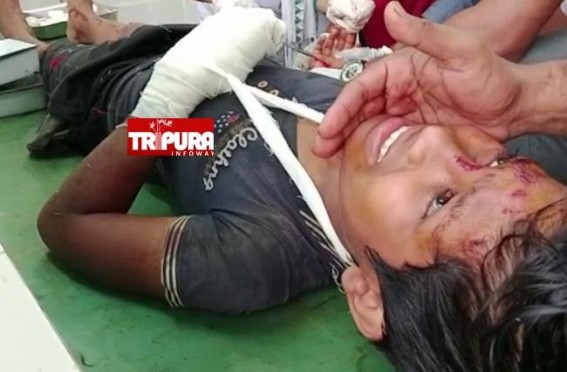 Bomb Blast injured Class-V Student in Boxanagar Bomb Blast injured Class-V Student in Boxanagar
